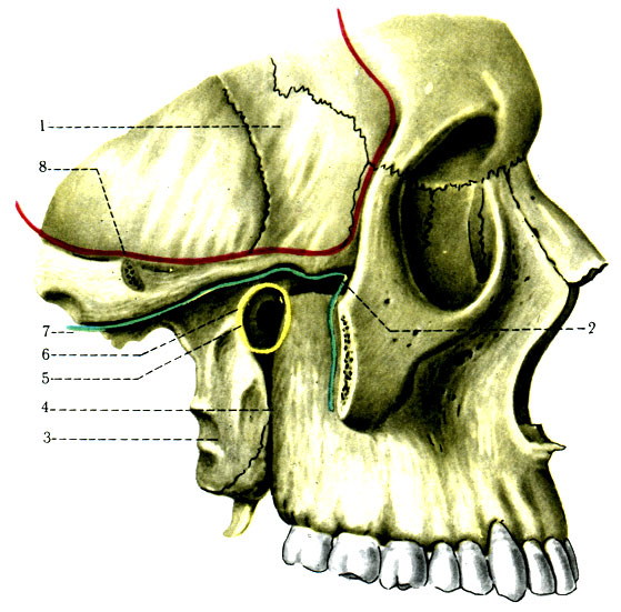 64.  (fossa temporalis),  (fossa infratemporalis),  (fossa pterygopalatina) . 1 - ala major ossis sphenoidalis; 2 - fissura orbitalis inferior; 3 - lamina lateralis processus pterygoidei; 4 - tuber maxillae; 5 - for. sphenopalatinum; 6 - fossa pterygopalatina ( ); 7 - fossa infratemporal ( ); 8 - fossa temporalis ( )