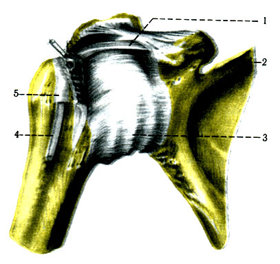 123.    ( . . ). 1 - lig. coracohumerale; 2 - scapula; 3 - capsula articularis; 4 - tendo m. bicipitis brachii; 5 - vagina synovialis intertubercularis