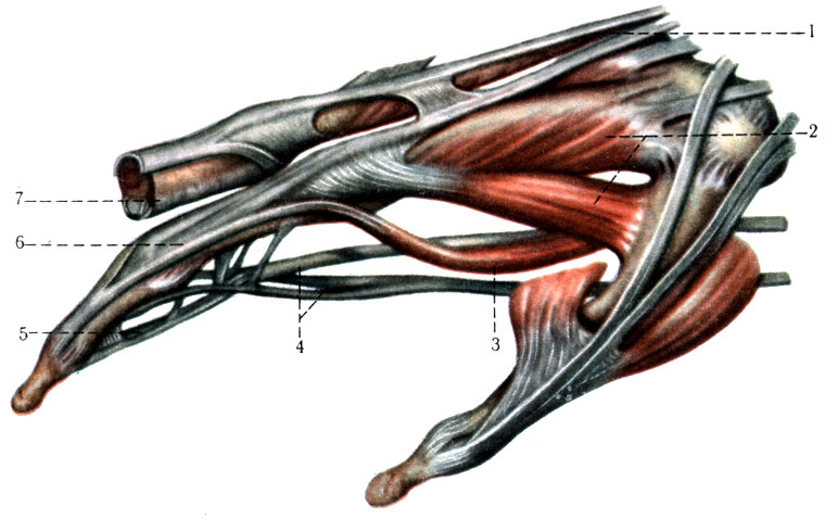 190.       ( . . ). 1 - m. extensor digitorum; 2 - m. interosseus; 1, 3 - m. lumbricalis I; 4 - chiasma tendineum (m. flexor digitorum superficialis  m. flexor digitorum profundus); 5 - tendo m. flexoris digitorum profundi; 6 - aponeuroses dorsalis; 7 - vagina fibrosa digitorum manus