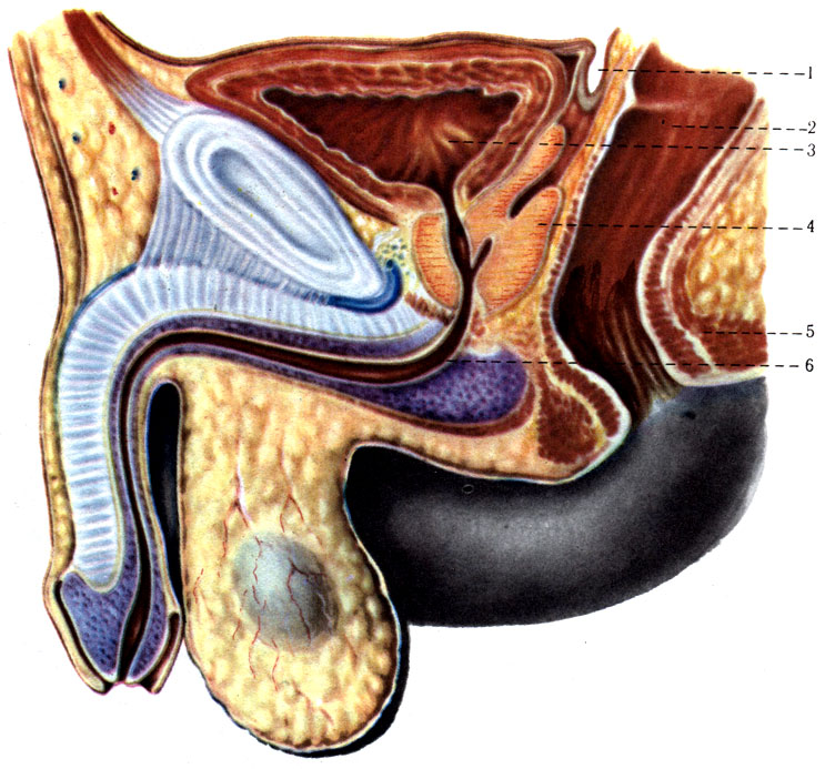 279.          (). 1 - excavatio  ectovesicalis; 2 - rectum; 3 - vesica urinaria; 4 - prostata; 5 - m. sphincter ani externus; 6 - urethra