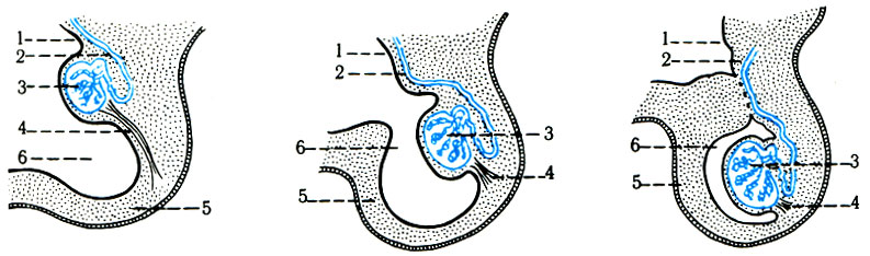 342.     . 1 - ; 2 -  ; 3 - ; 4 -  ; 5 - ; 6 - processus vaginalis