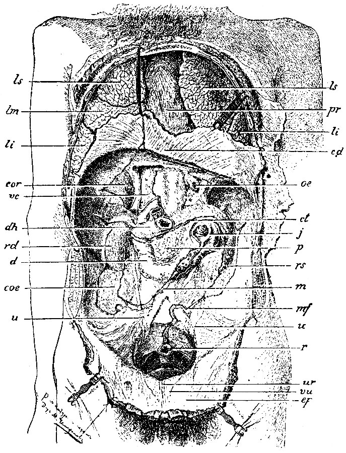 Фото внутренних органов человека брюшная полость с описанием у женщин строение