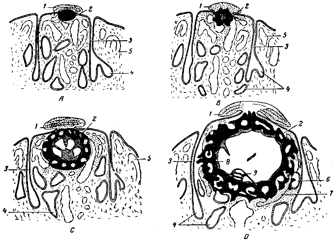 Рис. 14б. Схема внедрения зародыша в слизистую оболочку матки (из Щеголева по Петерсу). А, В, С, D - последовательные этапы. 1 - замыкающий сгусток; 2 - трофобласт; 3 - проток маточной железы; 4 - маточные железы; 5 - кровеносный сосуд; 6 - открывшаяся маточная железа; 7 - открывшийся кровеносный сосуд; 8 - внеэмбриональный мезобласт; 9 - зародыш