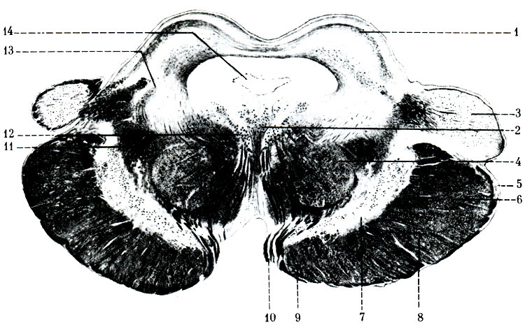 468.    . 1 - colliculus superior; 2 - nucl. n. oculomotorii; 3 - corpus geniculatum mediale; 4 - nucl. ruber; 5 - pedunculus cerebri; 6 - tr. corticopontinus; 7 - substantia nigra; 8 - tr. corticospinalis et nuclearis; 9 - tr. corticopontinus; 10 - III ; 11 - lemniscus medialis; 12 - fasc. longitudinalis medialis; 13 - tr. spinotectal; 14 - aqueductus cerebri