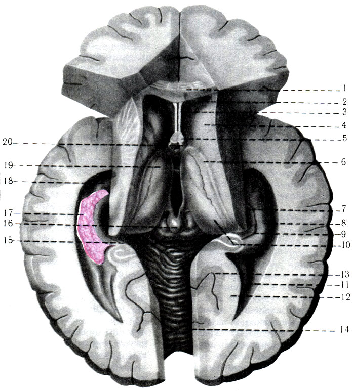 469.     . 1 - corpus callosum; 2 - cavum septi pellucidi; 3 - cornu anterius ventriculi lateralis; 4 - caput nuclei caudati; 5 - columnae fornicis; 6 - stria terminalis; 7 - gyrus dentatus; 8 - hippocampus; 9 - fimbria hippocampi; 10 - pulvinar; 11 - cornu posterius ventriculi lateralis; 12 - calcar avis; 13 - sulcus calcarinus; 14 - cerebellum; 15 - corpus pineale; 16 - tectum mesencephali; 17 - plexus chorioideus; 18 - cornu inferius ventriculi lateralis; 19 - tuberculum anterius thalami; 20 - commissura anterior