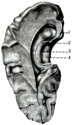475.     . 1 - uncus; 2 - fimbria hyppocampi; 3 - gyrus dentatus, 4 - gyrus parahippocampalis