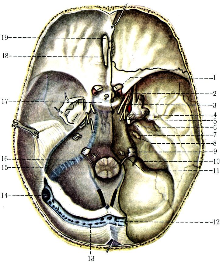 510.         . 1 - n. opticus; 2 - a. carotis interna; 3 - n. oculomotorius; 4 - n. trochlearis; 5 - n. abducens; 6 - n. trigeminus; 7 - n. facialis; 8 - n. vestibulochlearis; 9 - n. glossopharyngeus; 10 - n. vagus; 11 - n. hypoglossus; 12 - confluens sinuum; 13 - sinus transversus; 14 - sinus sigmoideus; 15 - sinus petiosus superior; 16 - sinus petrosus inferior; 17 - sinus intercavernousus; 18 - tr. olfactorius; 19 - bulbus olfactorius