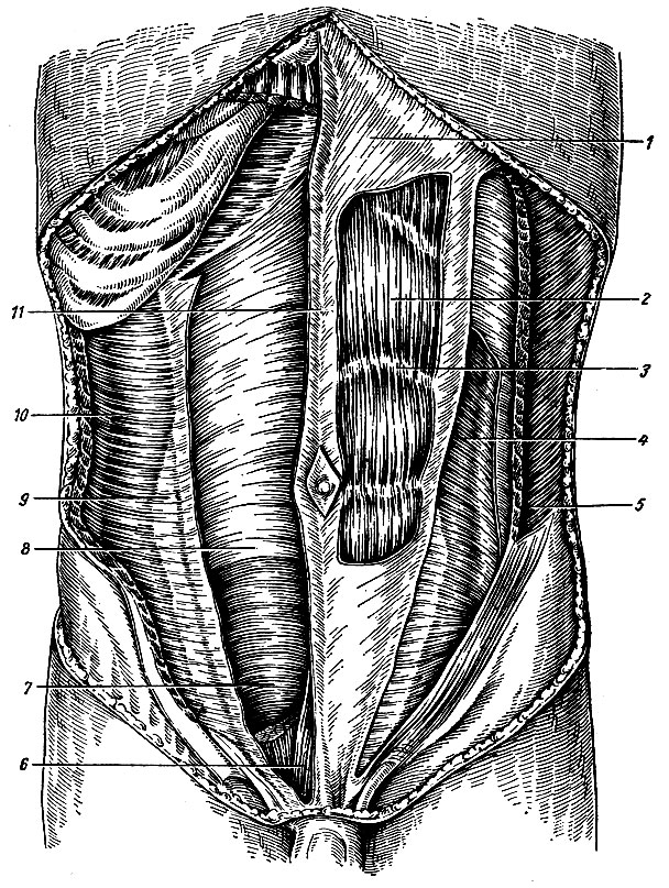 Рис. 58. Мышцы живота (справа прямая мышца удалена). 1 - влагалище прямой мышцы живота (передняя стенка); 2 - прямая мышца живота; 3 - сухожильная перемычка; 4 - внутренняя косая мышца живота; 5 - наружная косая мышца живота; 6 - пирамидальная мышца; 7 - поперечная фасция; 8 - задняя стенка влагалища прямой мышцы; 9 - апоневроз поперечной мышцы живота; 10 - поперечная мышца живота; 11 - белая линия живота