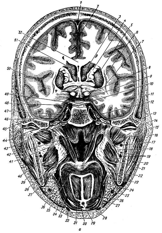 Рис. 74. Фронтальный распил головы, проведенный через спинку турецкого седла, задний отдел суставной впадины височной кости, ветви нижней челюсти. Передняя поверхность распила (по Н. И. Пирогову). а - рисунок распила; б - схема левой нижней части распила. 1 - верхний сагиттальный синус; 2 - серп большого мозга; 3 - хвостатое ядро; 4 - внутренняя капсула; 5 - чечевицеобразное ядро; 6 - наружная капсула; 7 - ограда; 8 - зрительный тракт; 9	- задняя соединительная артерия; 10	- глазодвигательный нерв; 11 - височная мышца; 12 - тройничный узел; 13 - суставная поверхность височной кости и суставной диск; 14 - клетчатка, заключенная между двумя листками височной фасции; 15 - околоушная слюнная железа; 16 - латеральная крыловидная мышца; 17 - верхнечелюстная артерия; 18 - interstitium interpterygoideum; 19 - нижние альвеолярные артерия и нерв; 20 - медиальная крыловидная мышца; 21, 26 - язычный нерв; 22 - шило-язычная мышца; 23 - поднижнечелюстная слюнная железа; 24 - подъязычная слюнная железа; 25 - лицевая артерия; 27 - язычная артерия; 28 - челюстно-подъязычная мышца; 29 - слизистая сумка; 30 - подбородочно-подъязычная мышца; 31 - подбородочноязычная мышца; 32 -двубрюшная мышца; 33 -подъязычно-язычная мышца; 34 - шило-подъязычная мышца; 35 - поперечная мышца языка; 36 - мягкое небо; 37 - мышца, натягивающая небную занавеску; 38 - хоаны; 39 - жевательная мышца; 40 - ветвь нижней челюсти; 41 - мышца, поднимающая небную занавеску: 42 - трубный валик: 43 - нижний конец сонной борозды; 44 - часть височной кости между чешуей и пирамидой; 45 - корень скулового отростка височной кости; 46 - внутренняя сонная артерия по бокам от турецкого седла; 47 - скат клиновидной кости; 48 - спинка турецкого седла; 49 - задний отклоненный отросток; 50 - боковая борозд мозга; 51 - боковой желудочек мозга; 52 - мозолистое тело