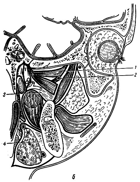 Рис. 76. Парасагиттальный распил головы, проведенный через наружную часть левой глазницы, шиловидный отросток, подвисочную ямку, барабанную полость (по Н. И. Пирогову). б - схема межчелюстного клетчаточного пространства. б; 1 - височно-крыловидная клетчаточная щель; 2 - верхнечелюстная артерия; 3 - межкрыловидная клетчаточная щель; 4 - фасциальное пространство поднижнечелюстной слюнной железы