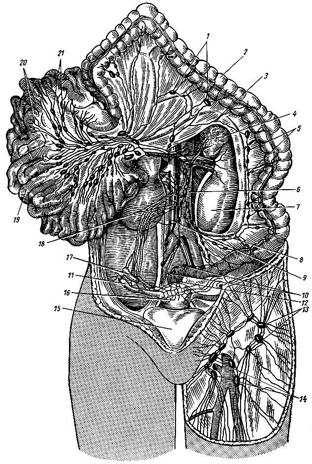 Рис. 183. Лимфатические сосуды и узлы брюшной полости. 1 - средние ободочные лимфатические узлы; 2 - поперечная ободочная кишка; 3 - лимфатические сосуды в брыжейке; 4 - надпочечник; 5 - левые ободочные лимфатические узлы; 6 - аорта; 7 - левая почка; 8 - нижняя брыжеечная артерия; 9 - нижняя полая вена; 10 - лимфатические узлы прямой кишки; 11 - маточная труба; 12 - прямая кишка; 13, 14 - поверхностные паховые лимфатические узлы; 15 - мочевой пузырь; 16 - матка; 17 - яичник; 18 - поясничные лимфатические узлы; 19 - тонкая кишка; 20 - лимфатические сосуды тонкой кишки (млечные сосуды); 21 - верхние брыжеечные лимфатические узлы