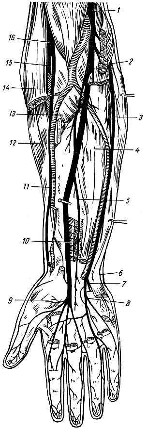 Рис. 222. Нервы плечевого сплетения в области предплечья и кисти. 1 - срединный нерв; 2 - круглый пронатор (отсечен); 3 - локтевой нерв; 4 - глубокий сгибатель пальцев; 5 - передний межкостный нерв; 6 - тыльная ветвь локтевого нерва; 7 - глубокая ветвь локтевого нерва; 8 - поверхностная ветвь локтевого нерва; 9 - мышцы возвышения большого пальца; 10 - квадратный пронатор; 11 - поверхностная ветвь лучевого нерва; 12 - длинный лучевой разгибатель запястья; 13 - поверхностный сгибатель пальцев (отсечен); 14 - плече-лучевая мышца (отсечена); 15 - глубокая ветвь лучевого нерва; 16 - лучевой нерв