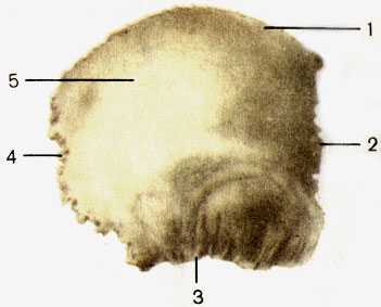 . 50.  ;  . 1 -   (margo sagittalis); 2 -   (margo frontalis); 3 -   (margo squamosus); 4 -   (margo occipitalis); 5 -   (tuber parietale)