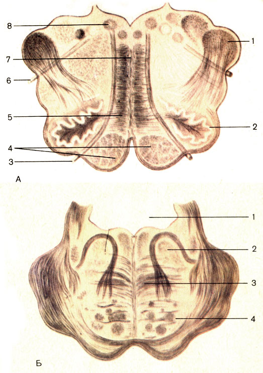 . 181.     ()   (). : 1 -    (pedunculus cerebellaris caudalis); 2 -    (nucleus olivaris caudalis); 3 -   (n. hypoglossus); 4 -    (pyramides); 5 -   (lemniscus medialis); 6 -   (n. vagus); 7 -    (raphe medullae oblongatae); 8 -    (nucleus nervi hypoglossi). : 1 -  IV ; 2 -   (tegmentum pontis); 3 -   (corpus trapezoideum); 4 - -  (fibrae corticospinales)