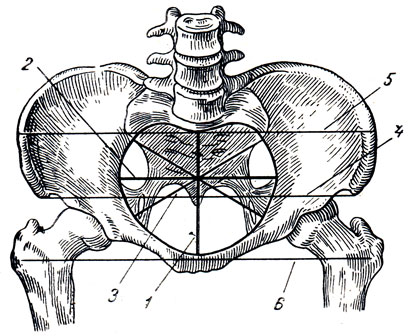 . 52.    . 1 -  , diameter recta (conjugata anatomica); 2 -  , diameter transversa; 3 -  , diameter obliqua (distantia obliqua): 4 -       , distantia spinarum; 5 -     , distantia cristarum; 6 -      , distantia trochanterica