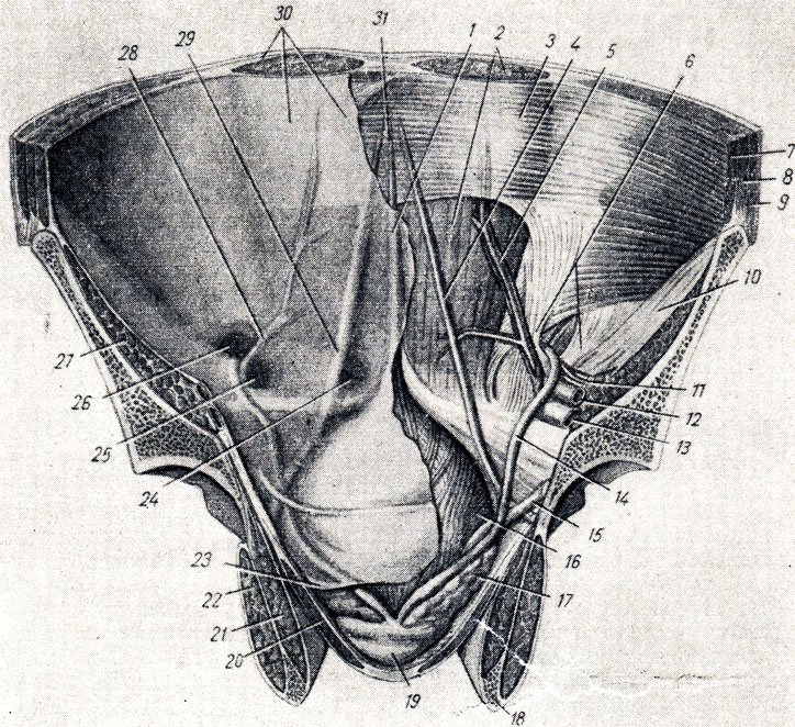 . 146.        ( -     ;  . . ). 1 - plica umbilicalis mediana; 2 - m. rectus abdominis; 3 - vagina m. recti abdominis (paries posterior); 4 - lig. umbilicale mediale; 5 - a. et vv. epigastricae inferiores: 6 - anulus inguinalis profundus; 7 - m. transversus abdominis; 8 - m. obliquus internus abdominis; 9 - m. obliquus externus abdominis; 10 - fascia iliaca 11 - vasa spermatica; 12 - a. iliaca externa; 13 - v. iliaca externa; 14 - ductus deferens; 15 - ureter; 16 - vesica urinaria; 17 - vesicula seminalis; 18 - os ischii; 19 - prostata; 20 - m. levator ani; 21 - m. obturatorius internus; 22 - m. obturatorius externus; 23 - peritoneum parietale; 24 - fossa supravesicalis; 25 - fossa inguinalis medialis; 26 - fossa inguinalis lateralis; 27 - m. iliopsoas; 28 - plica umbilicalis lateralis; 29 - plica umbilicalis medialis; 30 - peritoneum parietale  m. rectus; 31 - ligamentum umbilicale medianum