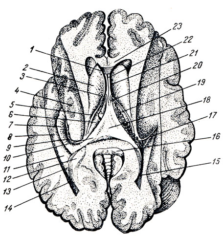 . 293.  ,          . 1 - cornu anterius; 2 - nucleus caudatus (caput); 3 - foramen interventricular; 4 - nucleus lentiformis ( ); 5 - stria terminalis; 6 -   thalamus; 7 - hippocampus; 8 - eminentia collateralis; 9 - fimbria hippocampi; 10 - crus fornicis; 11 - cornu posterior ventr. lat.; 12 -    ; 13 - calcar avis; 14, 15 - cornu posterius; 16 - splenium corporis callosi; 17, 19 - plexus chorioideus           ; 18 - commissura fornicis; 20 - columnae fornicis; 21 - septum pellucidum; 22 - cavum septi pellucidi; 23 - corpus callosum