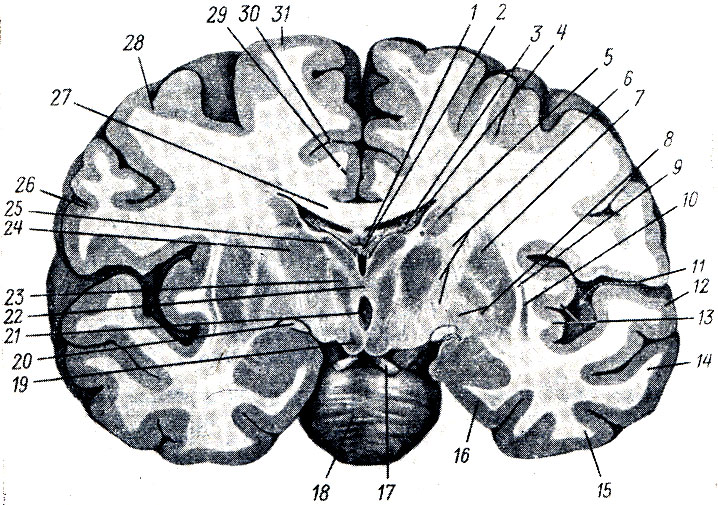 . 296.   ,   corpus striatum  thalamus. 1 - fornix; 2 - plexus chorioideus ventriculi tertii; 3 - plexus chorioideus ventriculi lateralis; 4 - ventriculus lateralis; 5 - nucleus caudatus; 6 - crus posterius  ; 7 - putamen; 8 - globus pallidus; 9 - capsula externa; 10 - claustrum; 11 - sulcus cerebri lateralis; 12, 14, 15 - gyri temporales superior, medius et inferior; 13 - insula; 16 - gyrus parahippocampalis 17 - n. oculomotorius; 18 - pons; 19 - nucleus corporis mamillaris; 20 - tractus opticus; 21 - ventriculus tertius; 22 - adhesio interthalamijpa; 23, 24, 25 -  thalamus; 26, 28, 31 - gyri frontales inferior, medius, superior; 27 - corpus callosum; 29 - gyrus cinguli; 30 - sulcus cinguli