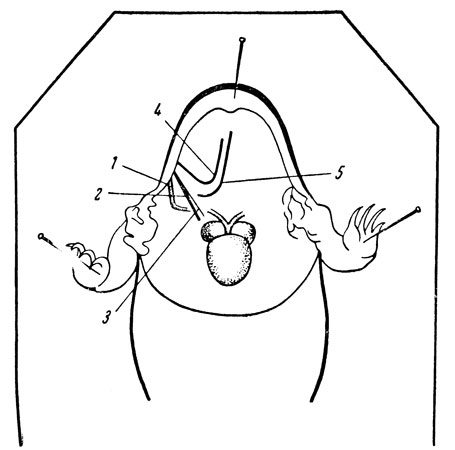 Рис. 28. Топография блуждающего нерва лягушки (иссечены грудина и обе ключицы с покрывающими их мышцами, удалена кожа, покрывающая нижнюю челюсть). 1 - вена (оттянутая); 2 - блуждающий нерв; 3 - длинный гортанный нерв (ветвь блуждающего нерва); 4 - языкоглоточный нерв; 5 - подъязычный нерв