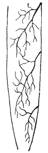 Рис. 10. Артерии m. gracilis человека