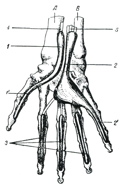Рис. 58. Синовиальные влагалища ладонной поверхности кисти. (Тестю.) А - лучевая кость, В - локтевая кость; 1 - наружное синовиальное влагалище, продолжающееся непосредственно в синовиальное влагалище костно-фиброзного канала I пальца, 2 - внутреннее синовиальное влагалище, непосредственно продолжающееся в синовиальное влагалище костно-фиброзного канала V пальца, 3 - синовиальные влагалища костно-фиброзных каналов II, III и IV пальцев, 4 - сухожилье длинного сгибателя большого пальца, 5 - сухожилье общего сгибателя пальцев