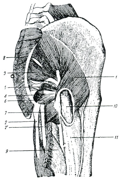 Рис. 64. Второй слой наружных мышц бедра, после того как была разрезана большая ягодичная мышца и задняя часть широкой фасции. (Тольдт.) 1 - средняя ягодичная мышца, 2 - сухожилье двуглавой мышцы бедра, 2' - сухожилье полуперепончатой мышцы, 3 - грушевидная мышца, 4 - внутренняя запирательная мышца (ее внетазовая часть), 5 - верхняя близнечная мышца, 6 - нижняя близнечная мышца, 7 - квадратная мышца бедра, 8 - начало большой ягодичной мышцы, откинутое в сторону, 9 - прикрепление большой ягодичной мышцы к бедренной кости, отвернутое назад, 10 - слизистая сумочка на месте соприкосновения сухожильной части большой ягодичной мышцы с большим вертелом, 11 - бедренная кость
