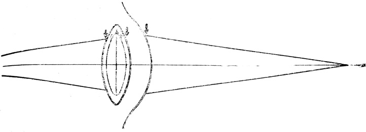 Рис. 44. Многократное изменение направления световых лучей при прохождении через оптическую систему глаза (стрелками показано, где изменяется направление светового луча)