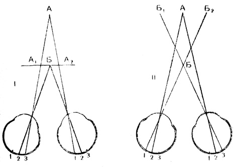 Рис. 54. Схема двоения предмета: I - глаза фиксируют предмет Б; II - глаза фиксируют предмет А. Идентичные точки сетчатки обозначены одинаковыми цифрами. Изображение нефиксируемого предмета падает на неидентичные точки сетчатки, а потому двоится