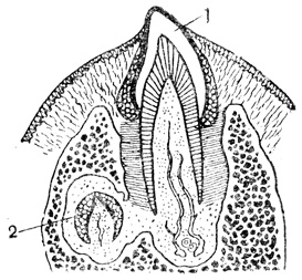 Рис. 83. Прорезывание молочного зуба (1); сбоку виден зачаток постоянного зуба (2)