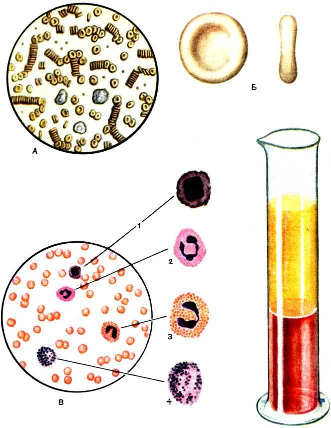 Таблица XIV. Кровь человека: А - кровь под микроскопом: видны три лейкоцита среди большого количества эритроцитов; Б - эритроцит; В - окрашенный препарат крови: 1 - лимфоцит; 2 - нейтрофил; 3 - эозинофил; 4 - базофил; Г - предохраненная от свертывания кровь после длительного отстаивания: между верхним слоем (плазмой) и нижним слоем (эритроцитами) виден тонкий слой лейкоцитов