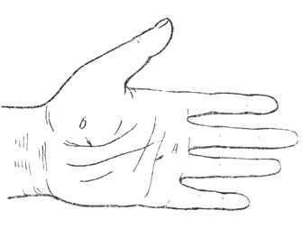 Рис. 2 Линии ладони, около которых образуются складки кожи: А - при сгибании II-IV пальцев, Б - при сгибании I пальца
