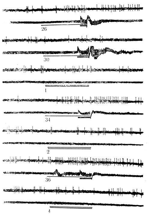 Рис. 31. Активирующие условные реакции нейрона слуховой коры на звук (щелчки 30 в 1 с) и торможение активности дифференцировочным стимулом (щелчки 10 в 1 с). Цифры на осциллограмме - число сочетаний или дифференцировок. Условный стимул обозначен тонкой линией, безусловный - толстой, дифференцировочный - двумя линиями. На каждой осциллограмме верхняя линия - разряды нейрона; нижняя линия - электромиограмма сгибателей передней конечности (Е. Л. Полонская, М. Я. Рабинович, 1971)
