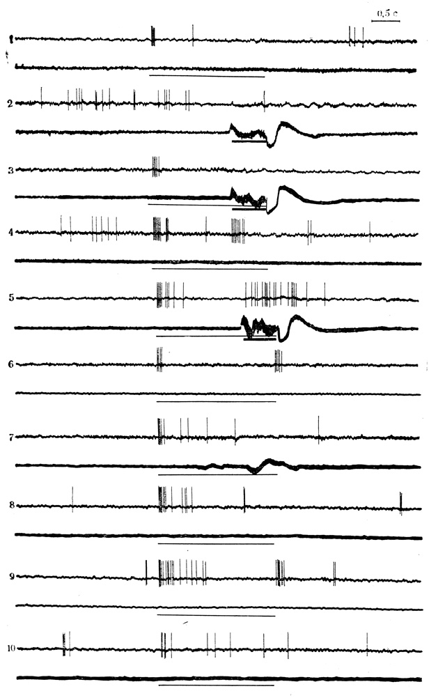 Рис. 34. Появление разрядов нейрона ВКТ на электрокожное раздражение конечности по мере сочетаний, воспроизведение их при  пропусках подкрепления и угашение этой следовой реакции. 1, 2 - контрольные пробы на звуковой стимул (тонкая линия) и электрокожное раздражение (толстая линия); 3 - 8-е сочетание звука (щелчки 20 в 1 с) с подкреплением; 4 - пропуск подкрепления в 9-м сочетании; 5 - 21-е сочетание; 6 - 10 -соответственно 4, 15, 20, 25 и 35-я пробы на угашение. На каждой осциллограмме: верхняя кривая - разряды нейрона, нижняя - ЭМГ сгибателей передней конечности (Е. Л. Полонская, М. Я. Рабинович, 1972)