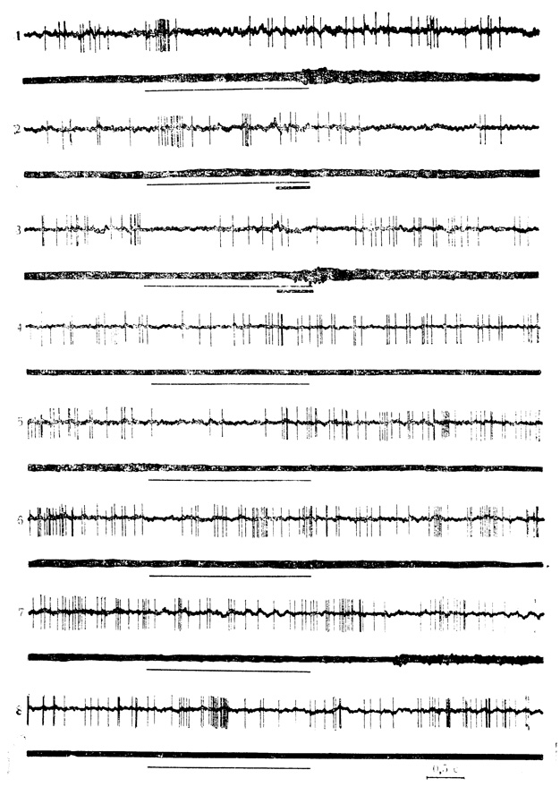 Рис. 35. Выработка тормозной условной реакции у нейрона ВКТ под влиянием угнетающего действия безусловного стимула и ее последующее угашение. 1 - контрольная проба на звуковой стимул (тонкая линия) 2 - 14-е (146-е), сочетание звука (щелчки 20 в 1 с) с электрокожным раздражением конечности (толстая линия); 3 - 26-е (158-е) сочетание; 4 - 8 - соответственно 5, 11, 16, 20 и 22-я пробы на угашение. Число сочетаний указано для данной клетки, в скобках - по отношению к животному. При угашении тормозной условной реакции клетки вновь появляется начальная пачка разрядов на звуковой стимул (Е. Л. Полонская, М. Я. Рабинович, 1972)