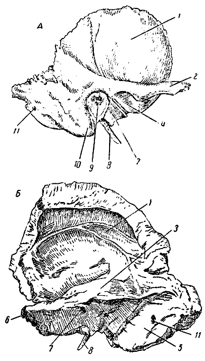 Височная кость (правая). А - вид снаружи; Б - вид изнутри; 1 - чешуя; 2 - скуловой отросток; 3 - передняя поверхность каменистой части; 4 - суставная ямка; 5 - сигмовидная борозда; 6 - верхушка пирамидки; 7 - на верхнем рисунке - барабанная часть; на нижнем рисунке - внутреннее слуховое отверстие; 8 - шиловидный отросток; 9 - наружное слуховое отверстие; 10 - сосцевидный отросток; 11 - сосцевидное отверстие [1967 Татаринов В Г - Анатомия и физиология]