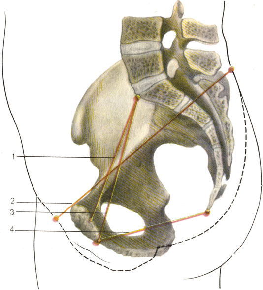    . 1  ,  ,  (conjugata vera); 2    (conjugata externa); 3    (conjugata diagonalis); 4        (diameter recta) [1989       -    ]